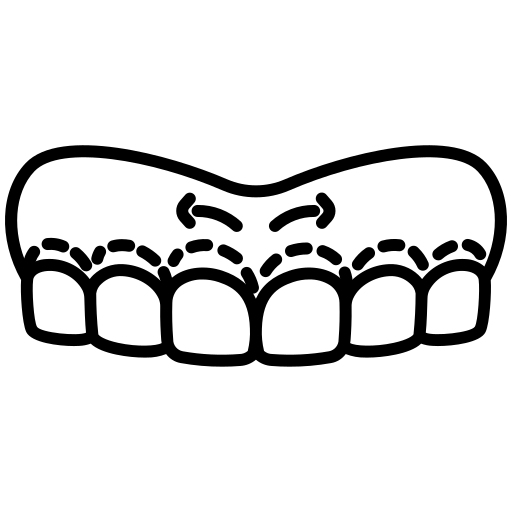 Plastische Zahnfleischgestaltung